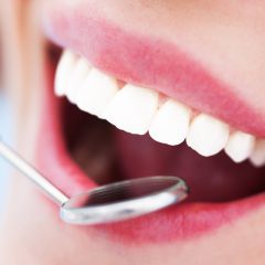 טיפול שיניים: מתי ולמה?